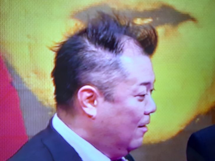 ブラマヨ小杉の髪の毛アップ画像